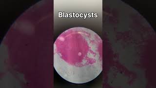 TS of ovary  TS of testis  ringworm bacteria under microscope biology animalkingdomclass11 [upl. by Ajup]