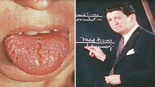 1944 The Impact of Vitamin Deficiencies – Scurvy Pellagra Beriberi amp More Explained [upl. by Sitoiganap]