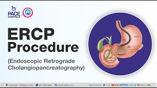 What is ERCP Test and How it is done  Department of Gastroenterology  Pace Hospitals [upl. by Portie]