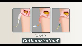 4 Minute Learning Urinary Catheterisation Male amp Care [upl. by Coreen]