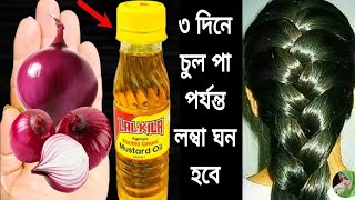 ৩ দিন এটা লাগাও চুল পড়া বন্ধ হবে চুল ঘন লম্বা কালো হবে নতুন চুল গজাবেhair growth remedies [upl. by Lorine167]