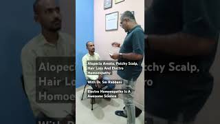 alopecia areata patchy scalp hair loss electro homoeopathy is a awesome science [upl. by Drahnreb]