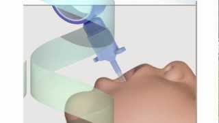 Neonatal Endotracheal Intubation [upl. by Aliwt]