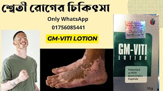 GMVITI Lotion শ্বেতী রোগের ছুলি শরিরের সাদা সাদা দাগে ব্যবহারের জন্য। [upl. by Halueb]