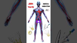 JenaValve short medical 3d animation Biology with Aliya [upl. by Eannej]