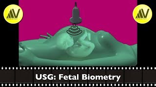 Fetal Biometry Part I [upl. by Vala987]