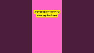 চোখের নিচের কালো দাগ কমানোর ১০০ সমাধান  100 solution to reduce dark circles under eyes [upl. by Anirehtac992]