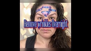 Get Rid Of Forehead Wrinkles Overnight Naturally [upl. by Ellac]