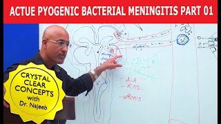 Acute Pyogenic Bacterial Meningitis Part 1 🩺 [upl. by Cordi]