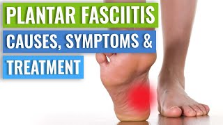 Plantar Fasciitis Causes Symptoms amp Treatment [upl. by Daahsar]