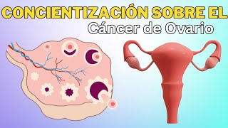 Concientización sobre el cáncer de ovario causas diagnóstico y tratamiento oncológico ginecológico [upl. by Dex932]