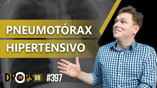 PNEUMOTÓRAX HIPERTENSIVO  COMO IDENTIFICAR NO RX [upl. by Nohsad]