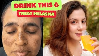 Drink this to treat Melasma amp Pigmentation  Nipun Kapur [upl. by Harwin]