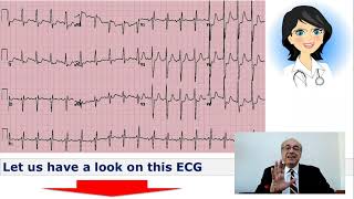 EKG Trainer Case 10 Questions [upl. by Einnaj]