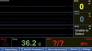 Simulated Adult Patient Monitor with Asystole Flatline – with Sound [upl. by Woodie612]