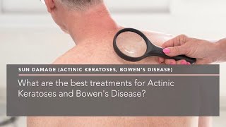 What are the best treatments for Actinic Keratoses and Bowens Disease [upl. by Aihsatan]