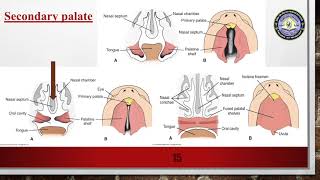 Medical Embryology  Head and neck Development  Tongue Thyroid gland  Face  Nasal cavity  Teeth [upl. by Aiki]