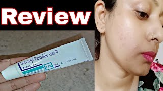 Benzoyl peroxide Gel 25mg  benzac ac 25 review  benzoyl peroxide for acne vulgaris Uses Dose [upl. by Olnton]