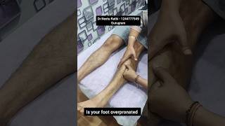 Pronated foot 🦶 feet 👣 trending ytshorts [upl. by Erastatus207]