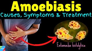 Amoebiasis  Amebiasis  Amoebic Dysentery – Symptoms Causes Treatment Complications Preventions [upl. by Muirhead]