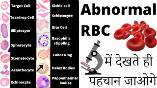 RBC Anomalies  RBC Abnormal Morphology  Inclusion bodies under microscope 🔬 [upl. by Ecnatsnoc]