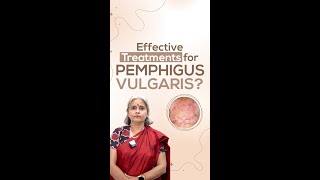 Effective Treatments for Pemphigus Vulgaris [upl. by Esydnac310]