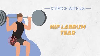 Stretch With Us  Hip Labrum Tear [upl. by Gunthar421]