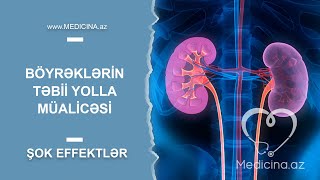 Böyrəklərin təbii yolla müalicəsi Şok effektlər [upl. by Hornstein]