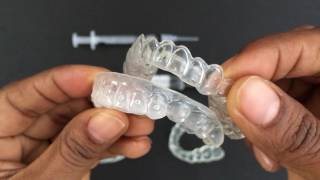 How to use Tooth Whitening Trays [upl. by Guthrie]