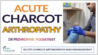 Charcot Arthropathy Understanding and Managing Charcot Foot  Dr Premkumar Podiatrist [upl. by Julita]