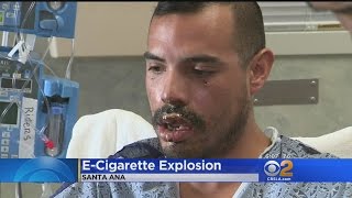 Tustin Man Recovering After ECig Explodes In His Mouth [upl. by Velasco986]