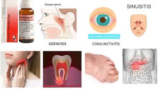 Top antiinflammatory homeopathy medicine  Dr Reckeweg R1 Inflammation drops [upl. by Socem]