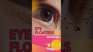 നിങ്ങളുടെ കണ്ണിലെ floaters നെ കൂടുതൽ അറിയാം malayalam eyecare floa [upl. by Nitsew]