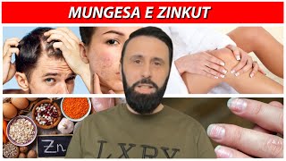 Askush nuk ju ka thënë deri më sot që mungesa e zinkut sjell gjithë këto probleme [upl. by Bumgardner]