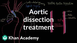 Aortic dissection treatment  Circulatory System and Disease  NCLEXRN  Khan Academy [upl. by Yentroc]