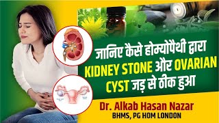 How Homeopathy Cured Her Kidney Stone and Ovarian Cyst in Just Weeks  Dr Nazar Homeopathy  Kanpur [upl. by Birk934]