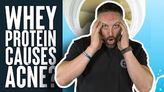 Whey Protein Causes Acne  Educational Video  Biolayne [upl. by Virg815]