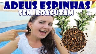 ADEUS ESPINHAS CRAVOS E MANCHAS SEM ROACUTAM  Fran Adorno [upl. by Yelda415]