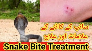 Snake bite treatmentsnake bite injection snake bite symptomssnake bite drugssnake bite first aid [upl. by Oirevlis129]