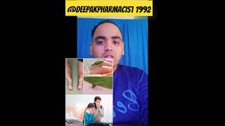 What is anti allergic drug use side effects Deepakpharmacist1992 [upl. by Layne110]