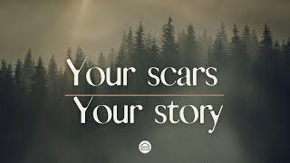 Rev Raymond Butler  Your Scars Your Story Sermon [upl. by Hilly]