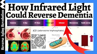 HOW Infrared Light Could REVERSE Dementia [upl. by Parlin]