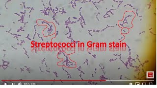 Streptococcus agalactiae [upl. by Ettenawtna]