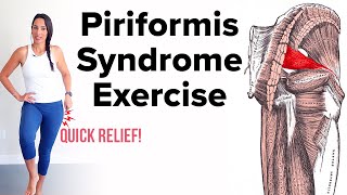 The Best Piriformis Syndrome Exercise For Lasting Relief [upl. by Assirk]