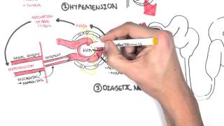 Chronic Kidney Disease CKD Pathophysiology [upl. by Regazzi826]