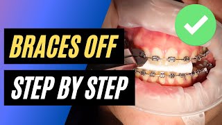 BRACES OFF  Step by step orthodontic removal [upl. by Gnurt]