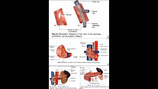 Pancreas Relations Anatomy Quick Revision University Exam [upl. by Ynomrah]