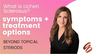 Treatment Option for Lichen Sclerosus [upl. by Pappas232]