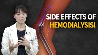 Hemodialysis Side Effects How It Works amp What You Need to Know [upl. by Alexina]