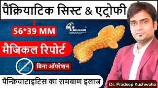 Atrophy Pancreatitis Treatment  Pseudocyst Pancreatitis treatment hindi  Best Pancreas treatment [upl. by Aehsa]